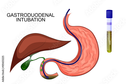 duodenal sounding stomach, gaster, liver photo