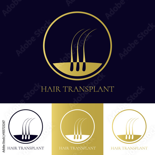Hair transplant logo template with three hair bulbs in a circle. Hair loss treatment concept. Hair medical diagnostics label. Hair follicle icon. Hair bulb symbol. Vector illustration.