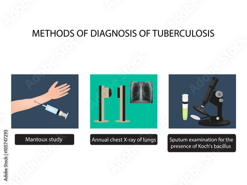 TB diagnostic methods. X-rays of light. Mantoux test. Examination of sputum. World Tuberculosis Day. Infographics. 