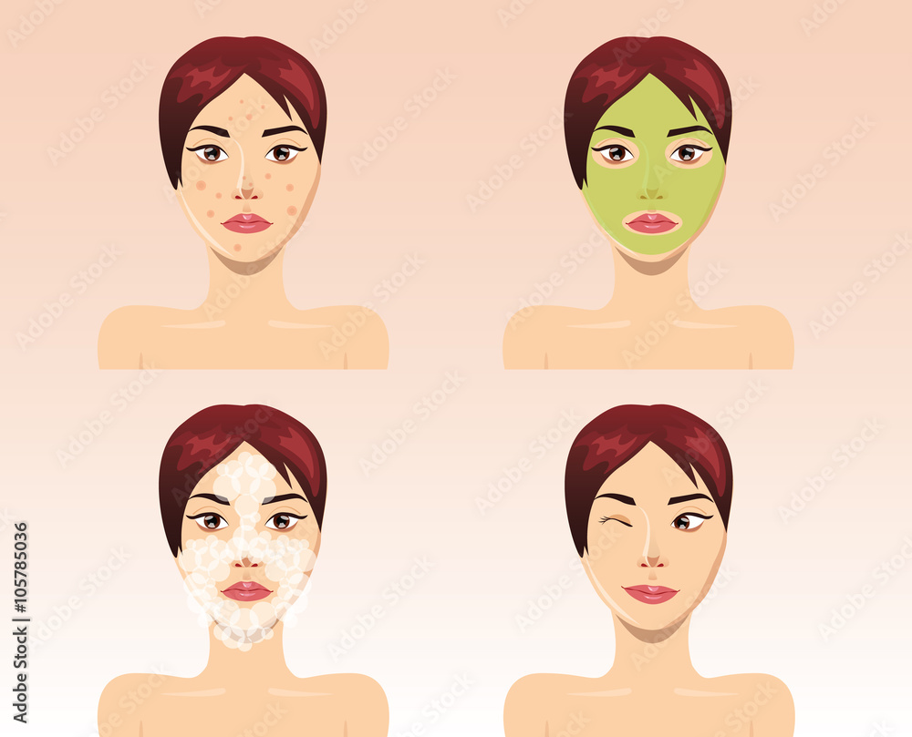 Beautiful woman face in process of acne treatment, vector Beautiful woman face in process of acne treatment, vector