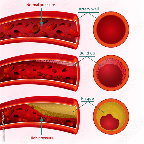 Blood Vector Image