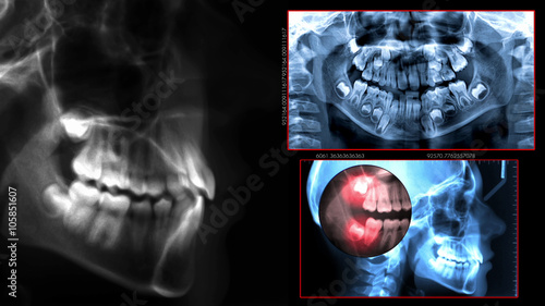 radiography dental scan