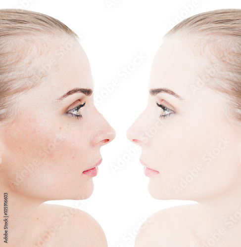 Closeup face of beautiful young woman before and after retouch