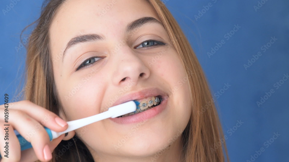Beautiful smiling girl with retainer for teeth brushing teeth . Beautiful smiling girl with retainer for teeth brushing teeth .