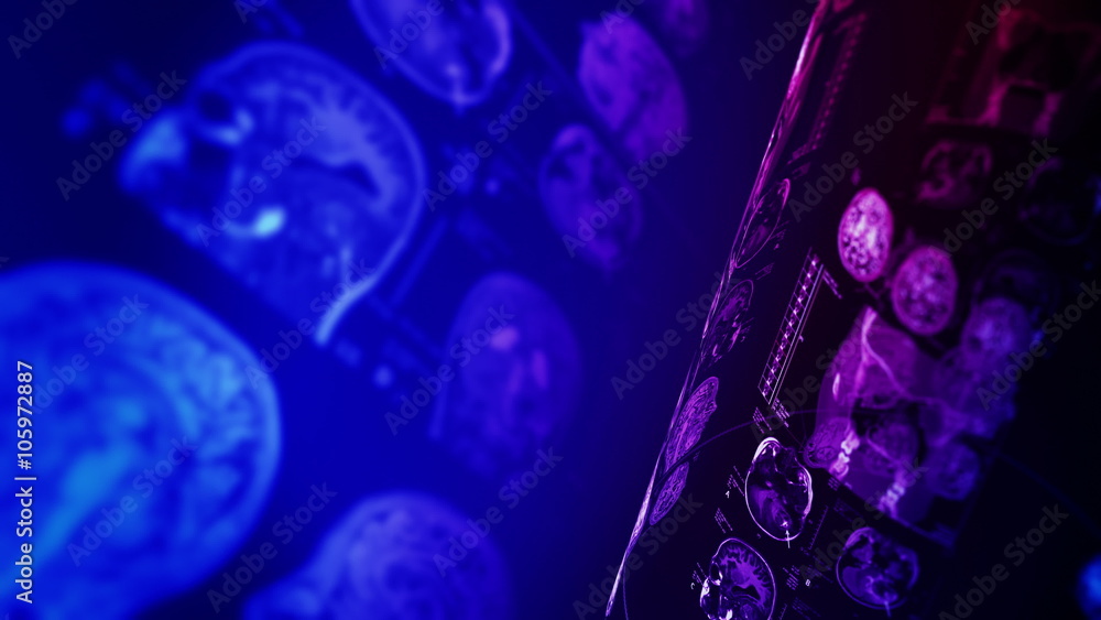 Medical, clinical background. CT scans, X-ray computed tomography of ...
