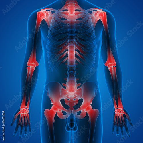 Human Body Joint Bone Pains photo