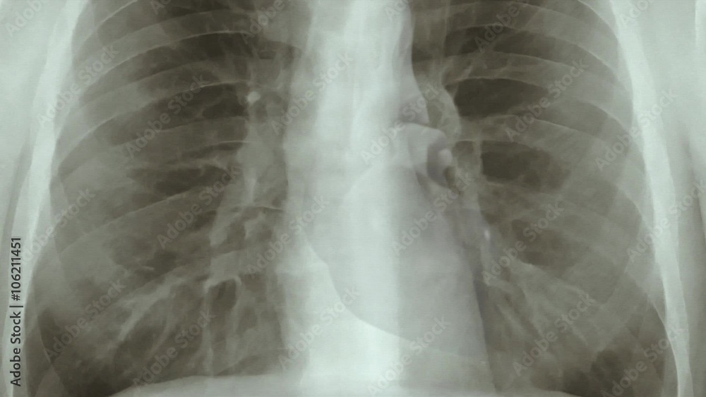 Chest x-ray scan from top to bottom. (loop ready animation) Chest x-ray scan from top to bottom. (loop ready animation)