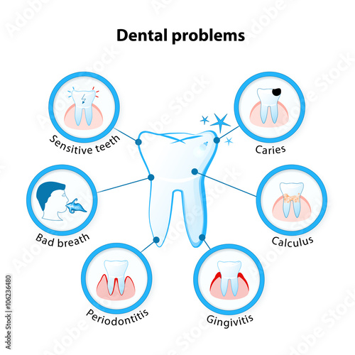 dental problem