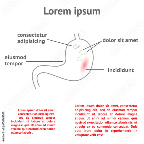 treatment of stomach ache