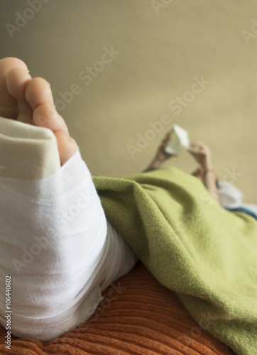 Man Laying in Bed with Broken, Sprained, or Fractured Foot, Toes, or Ankle. Close-up of Cast, Wrap