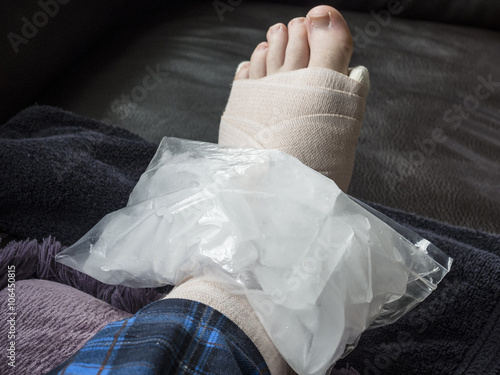 Konstfotografi Icing Broken, Fractured or Sprained Foot or Ankle in Cast or Compression Wrap