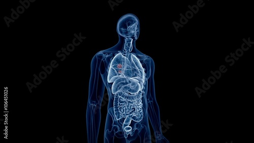 medical 3d animation of the lung cancer  photo