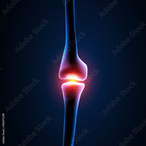 Pain in the knee area easy editable
