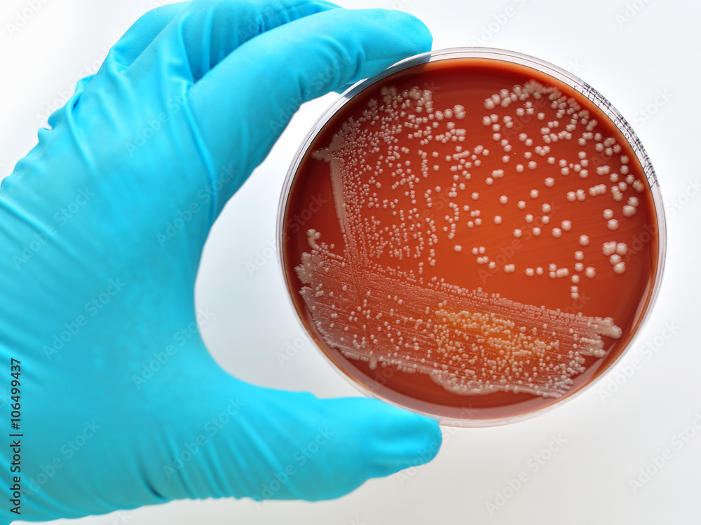 Colonies of bacteria in culture medium plate foto de Stock | Adobe Stock