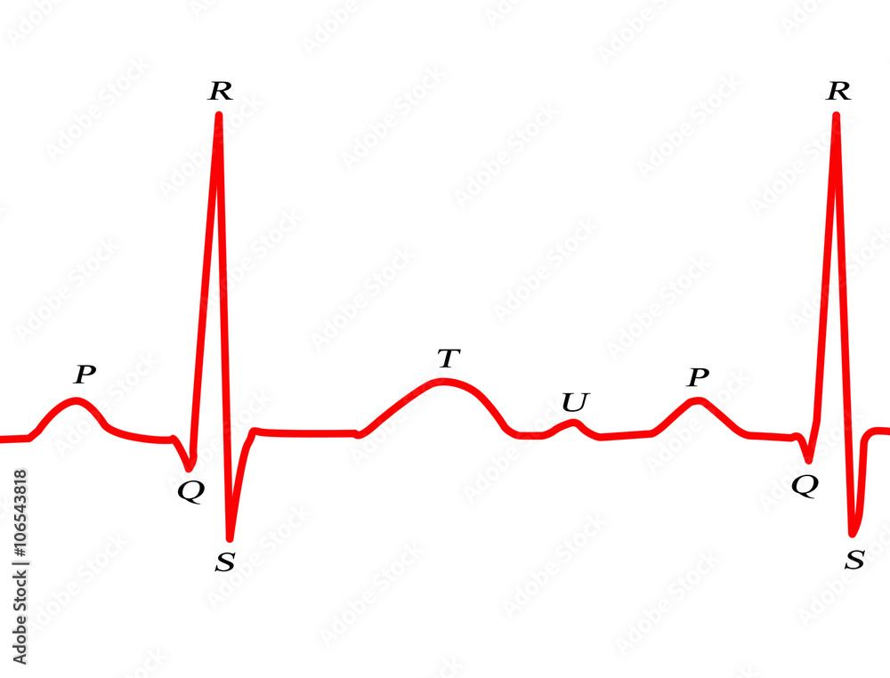 ECG ECG
