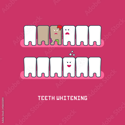 Teeth before and after bleaching