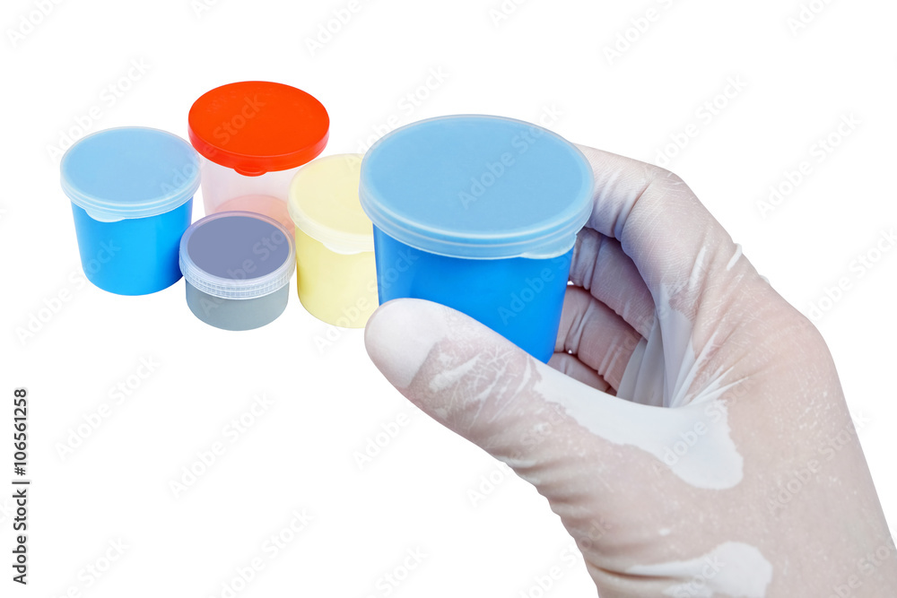blue urine container held by hand with other urine and sputum blue urine container held by hand with other urine and sputum