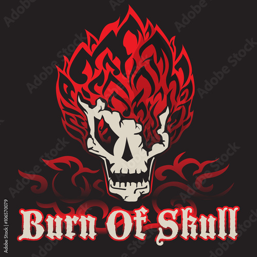 burn of skull