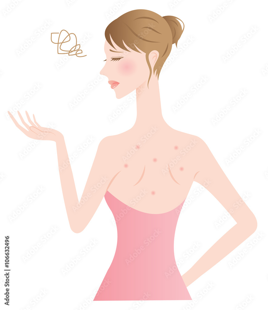 背中ニキビの女性 背中ニキビの女性