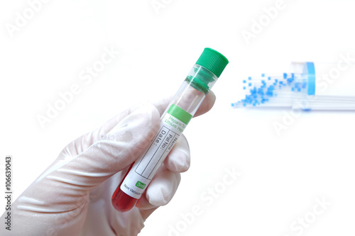 Lithium Heparin blood collection tube,with green plastic stopper