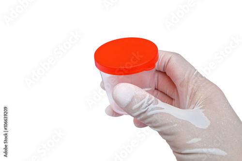 transparent urine container with red lid held by hand (isolated