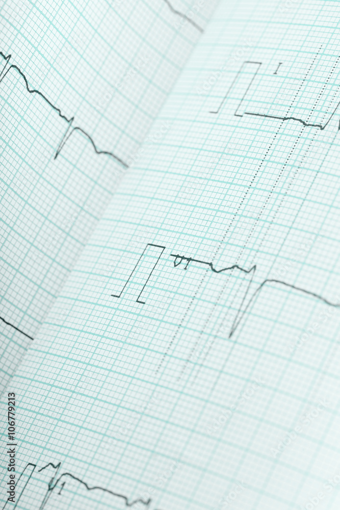 ECG medical background ECG medical background