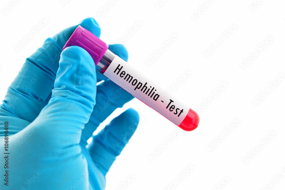 Obraz premium Hemophilia test 