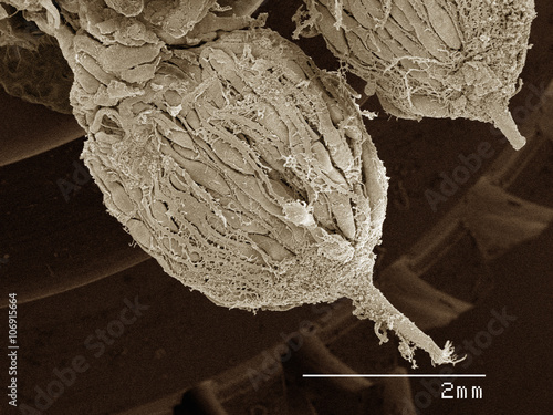 Coloured SEM of cicada ovaries photo