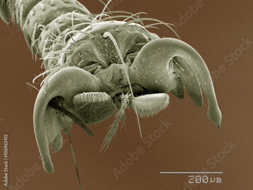 Coloured SEM of louse fly (Hippoboscidae) tarsus