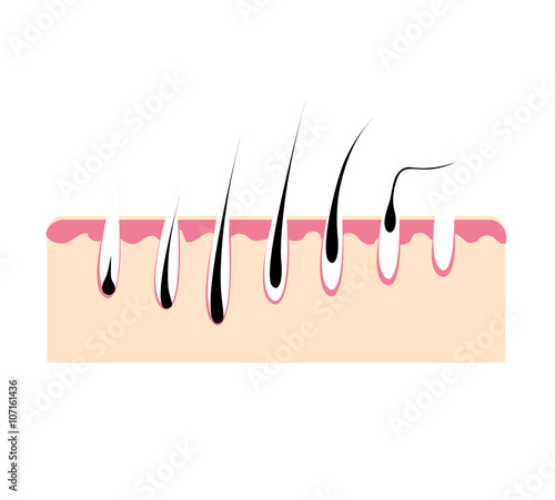  Loss hair, growth hair problem, health hair. Hair growth phase.