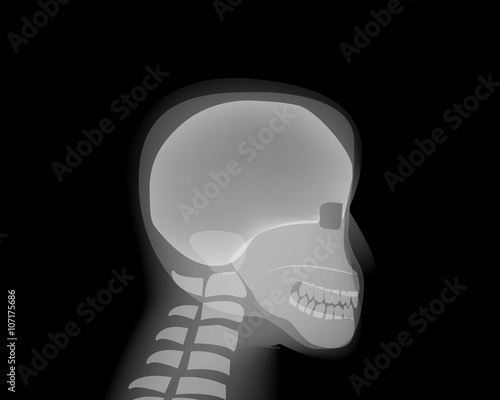 Side view Human head skull on x-ray film