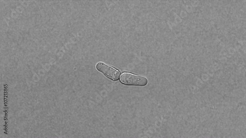 Fission yeast (Schizosaccharomyces pombe) reproduction under microscope
