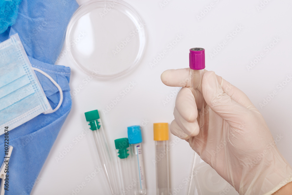 Test tube in the palm of a lab technician. Closeup Test tube in the palm of a lab technician. Closeup