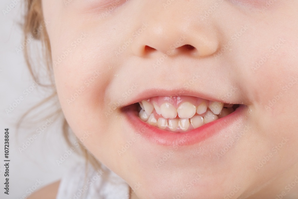 Fototapeta premium Teeth of a three years old child