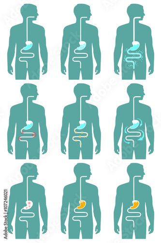 human digestive system, vector illustration of digestion tract disease