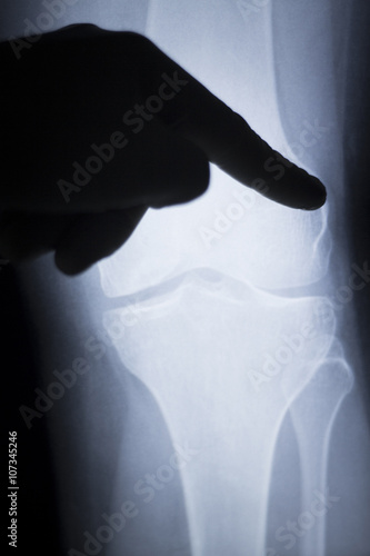 Knee injury surgeon xray scan