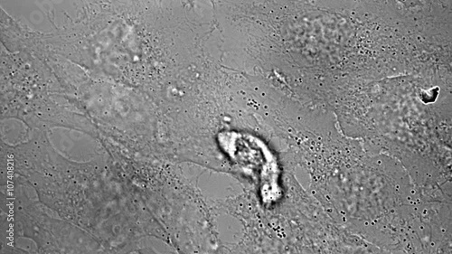 Movement, division and death of HeLa cervical cancer cells under microscope
 photo