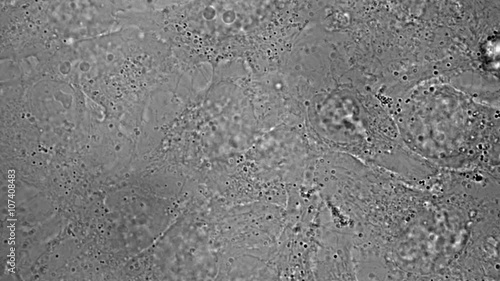 Movement, division and death of HeLa cervical cancer cells under microscope
