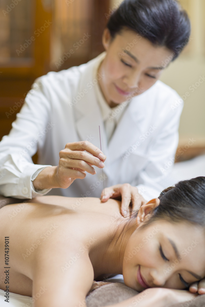 Young woman receiving acupuncture Young woman receiving acupuncture