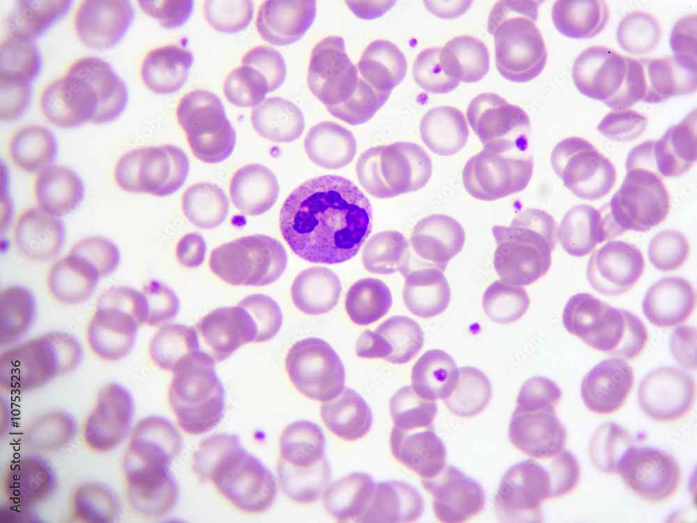 Fotografia do Stock: Neutrophil cell (white blood cell) in peripheral ...