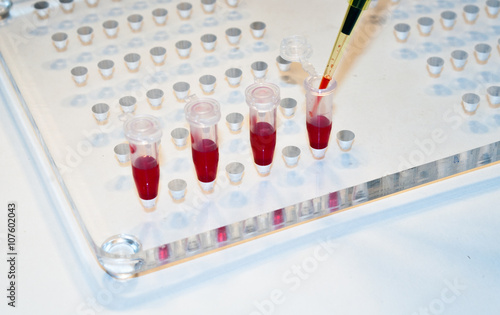 In medical laboratories studied blood.