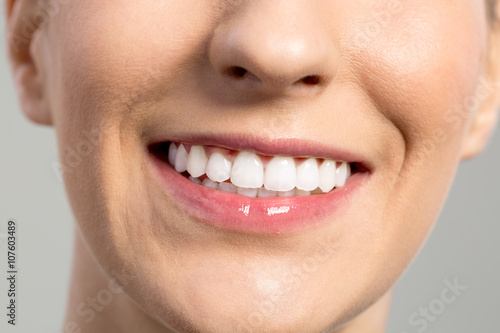 Woman smile  Teeth whitening  Dental care