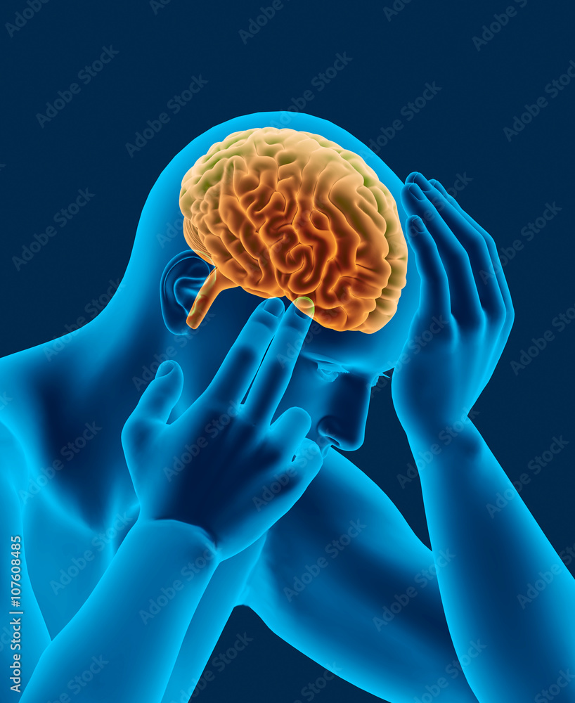 headache xray scan of human head with brain side view Stock