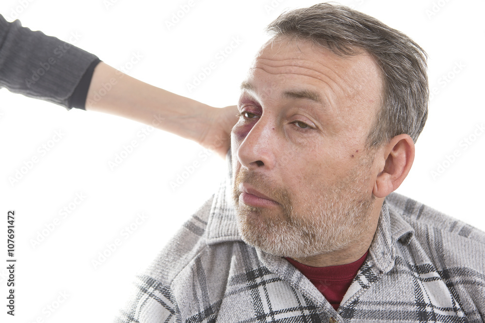Obraz premium Middle-aged Caucasian male Emotional Portrait with a Real Bruise