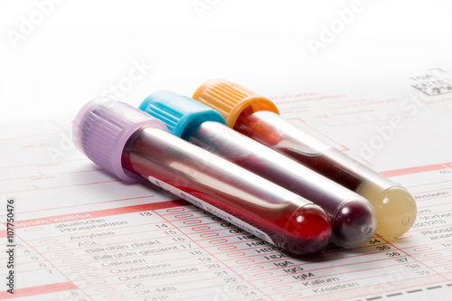 Blutuntersuchung, Blutproben auf einem Laborformular