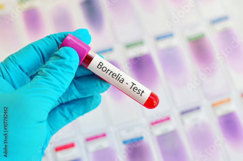 Blood sample for Borrelia test (Lyme disease diagnosis) 
 photo