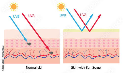 Infographic about sunscreen lotion protect human skin from UVA , © PeoGeo