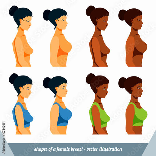 Shape of a woman`s breast. Before and after plastic surgery. Before and after boost breast shape by exercises. Women torsoes - vector illustration.