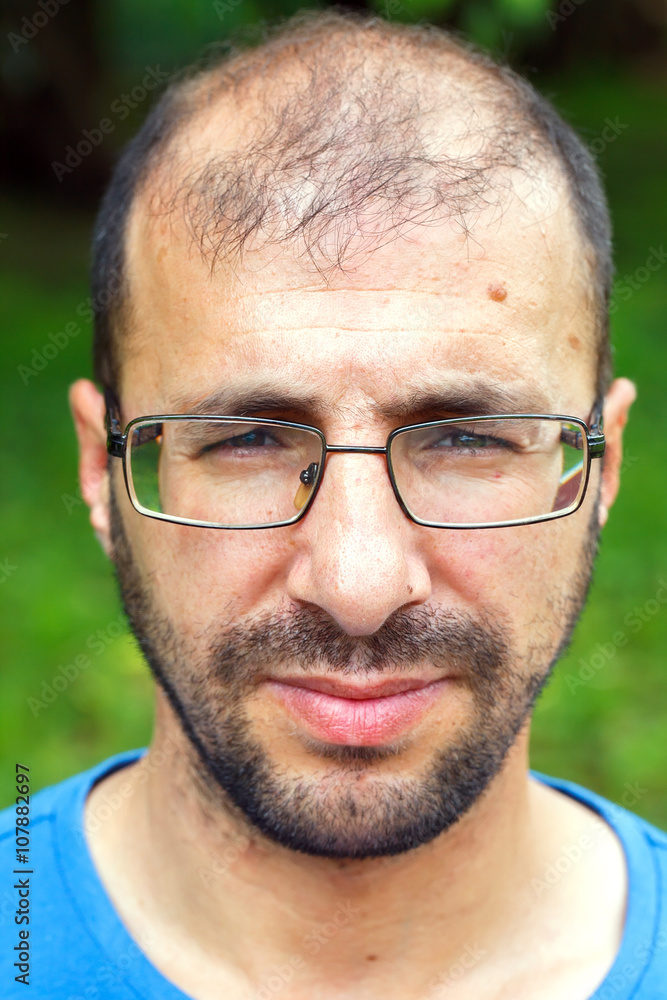 portrait of young man with bad eyesight and hair loss. portrait of young man with bad eyesight and hair loss.