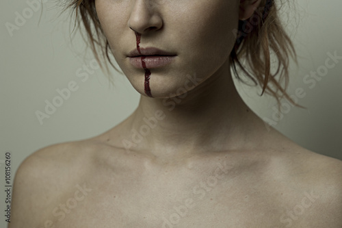 Obraz na plátně ragazza picchiata_4